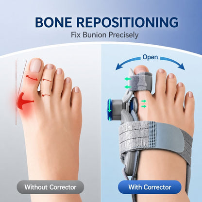 Corriva™ 3-in-1 PRO - Bunion Corrector